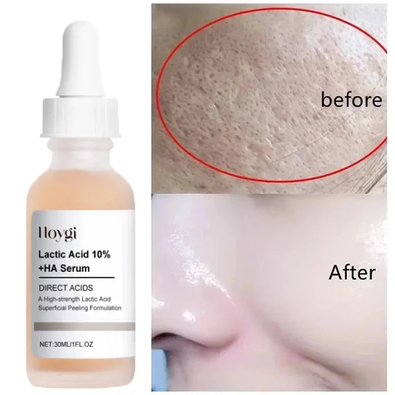 Lactic Acid Pore Tightening Serum – Smooth & Hydrate Skin