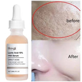 Lactic Acid Pore Tightening Serum – Smooth & Hydrate Skin