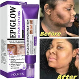 Brightening Freckle Removal Face Serum – Whitening & Hydrating