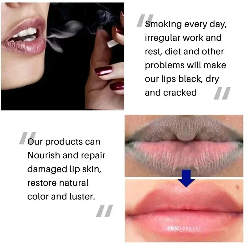 Hydrating Lip Balm – Moisturizing & Nourishing, 7g