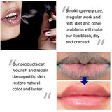 Hydrating Lip Balm – Moisturizing & Nourishing, 7g