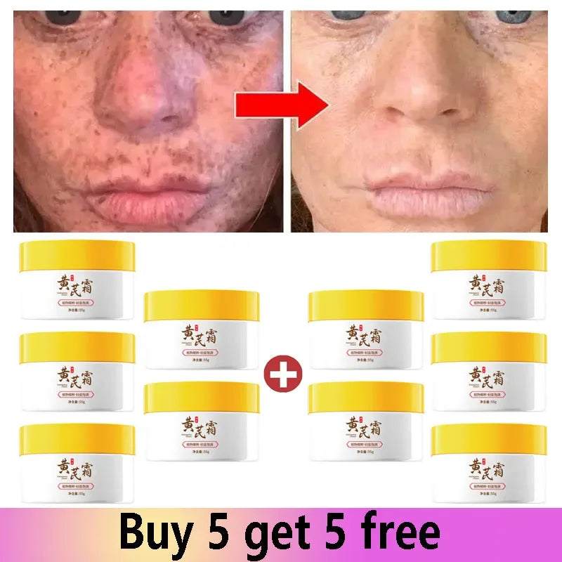 Astragalus Freckle Cream – Dark Spot Remover & Brightening (55g)