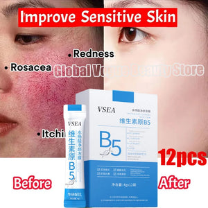 B5 Facial Redness Repair Cream for Sensitive & Acne-Prone Skin – Hydrating & Calming