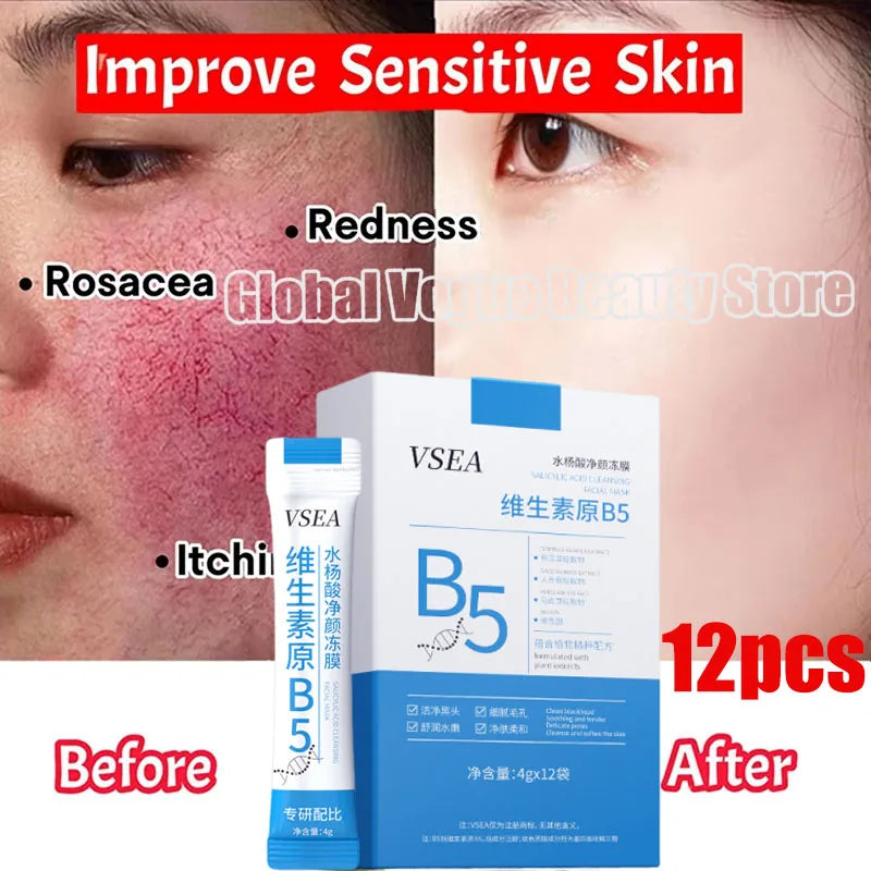 B5 Facial Redness Repair Cream for Sensitive & Acne-Prone Skin – Hydrating & Calming