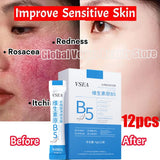 B5 Facial Redness Repair Cream for Sensitive & Acne-Prone Skin – Hydrating & Calming