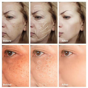 Dark Spot Remover & Whitening Face Cream – Vitamin C Brightening