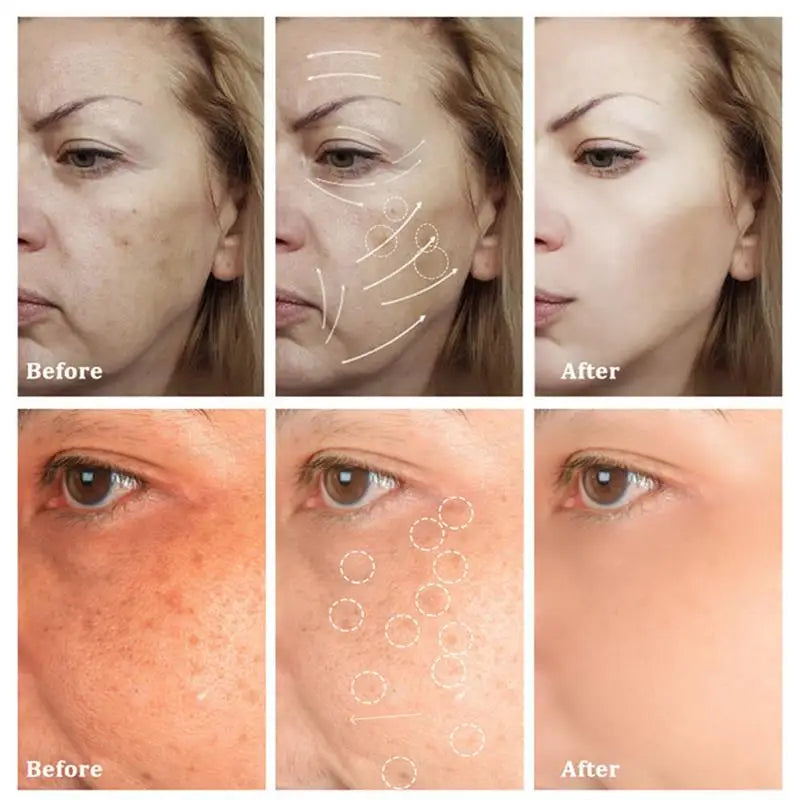Dark Spot Remover & Whitening Face Cream – Vitamin C Brightening