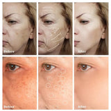 Dark Spot Remover & Whitening Face Cream – Vitamin C Brightening