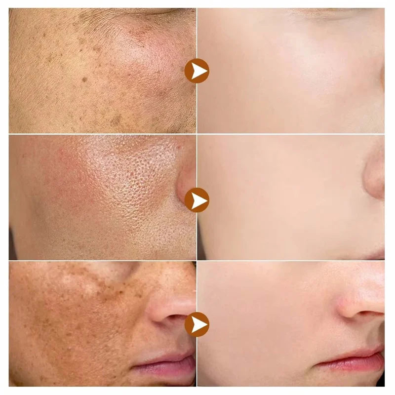 Dark Spot Whitening Repair Serum – Anti-Aging & Pore Minimizer