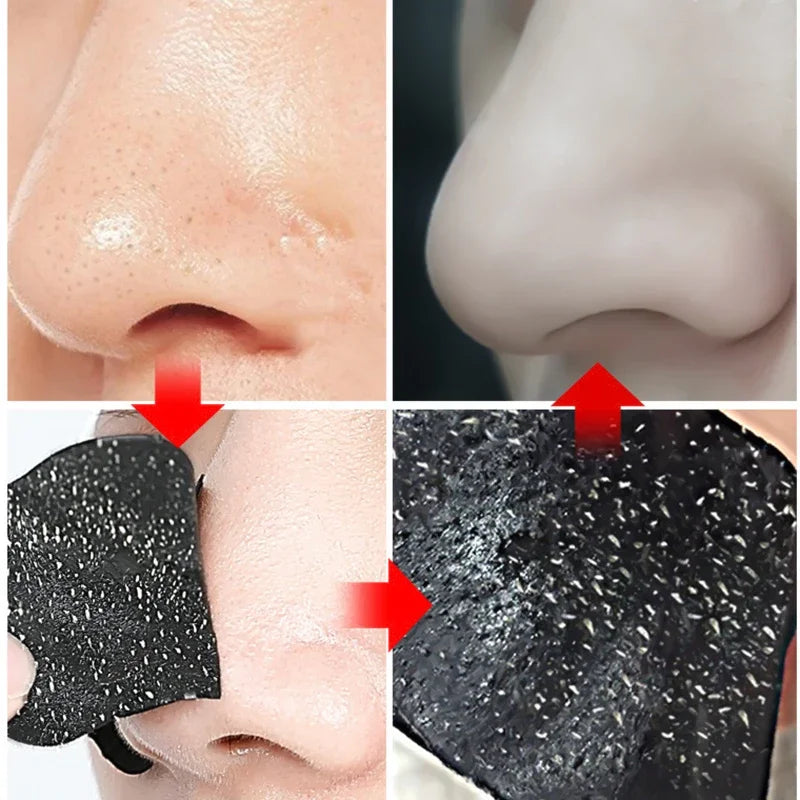 Blackhead Removal Nose Strips – Deep Cleansing & Pore Refining