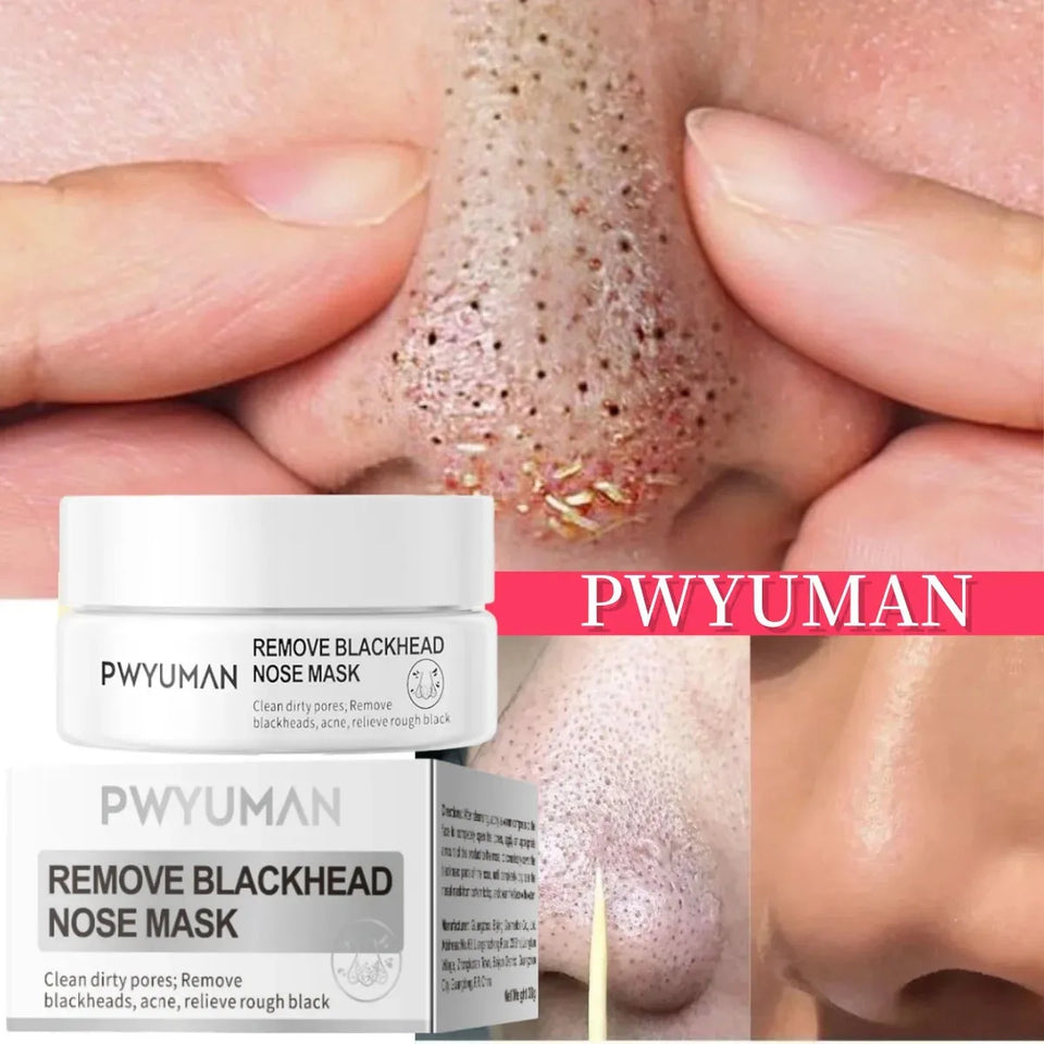 Blackhead Removal Nose Strips – Deep Cleansing & Pore Refining