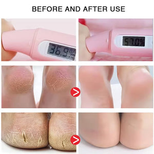 Cracked Heel Repair Foot Cream Spray – Exfoliating & Moisturizing 100ml