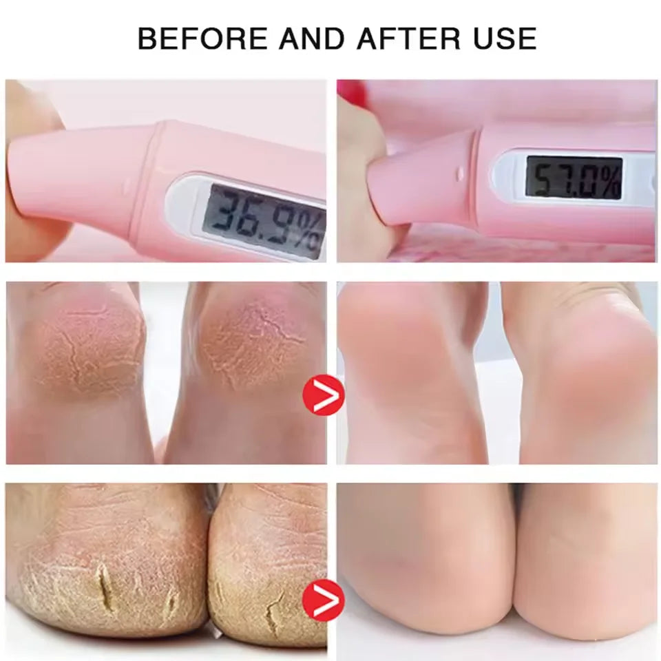 Cracked Heel Repair Foot Cream Spray – Exfoliating & Moisturizing 100ml