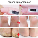Cracked Heel Repair Foot Cream Spray – Exfoliating & Moisturizing 100ml