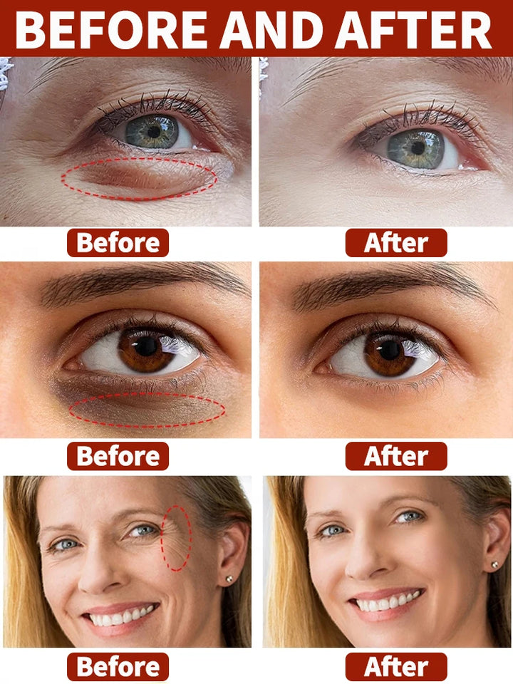 Snail Collagen Eye Cream for Dark Circles & Puffiness
