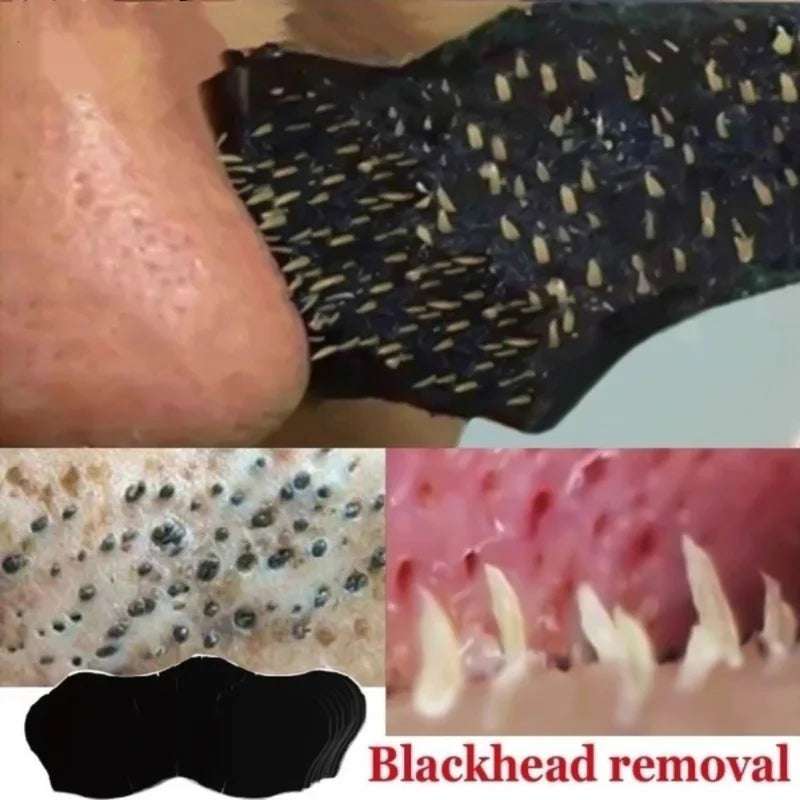 Blackhead Removal Nose Strips – Deep Cleansing & Pore Refining