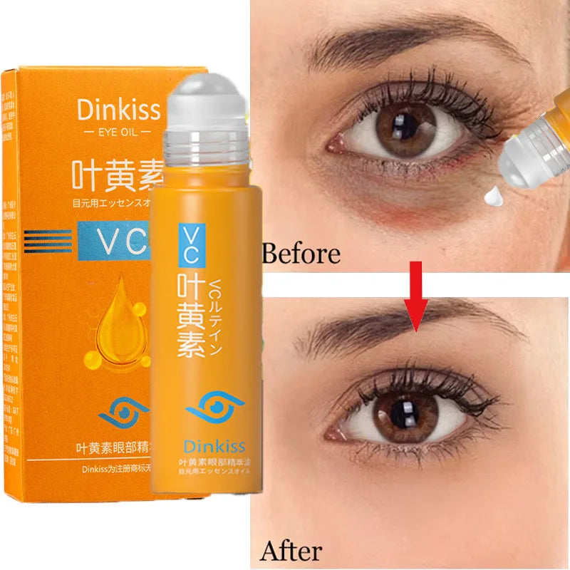 Vitamin C Eye Cream for Dark Circles & Puffiness – 1 Unit