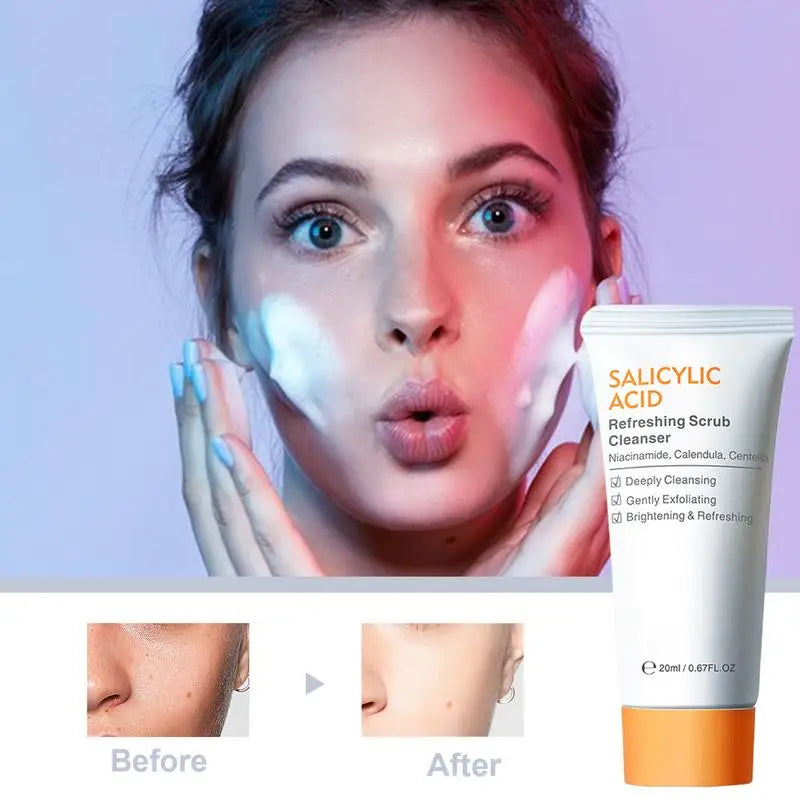 Salicylic Acid Acne Cleanser – Pore Minimizing Scrub 20ml