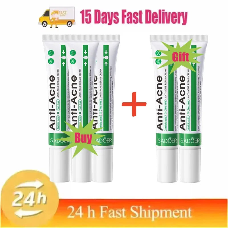 Salicylic Acid Acne Treatment Cream – Anti-Pimple & Oil Control