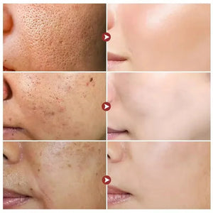 White Rice Brightening Face Serum – Anti-Aging & Hydrating