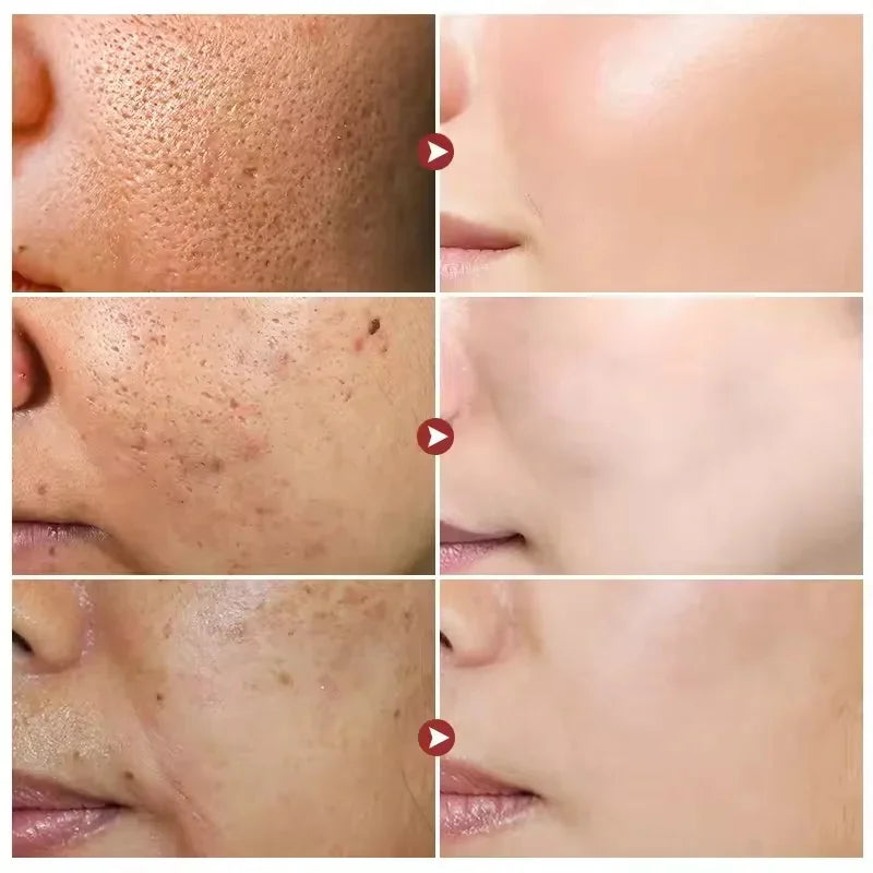 White Rice Brightening Face Serum – Anti-Aging & Hydrating
