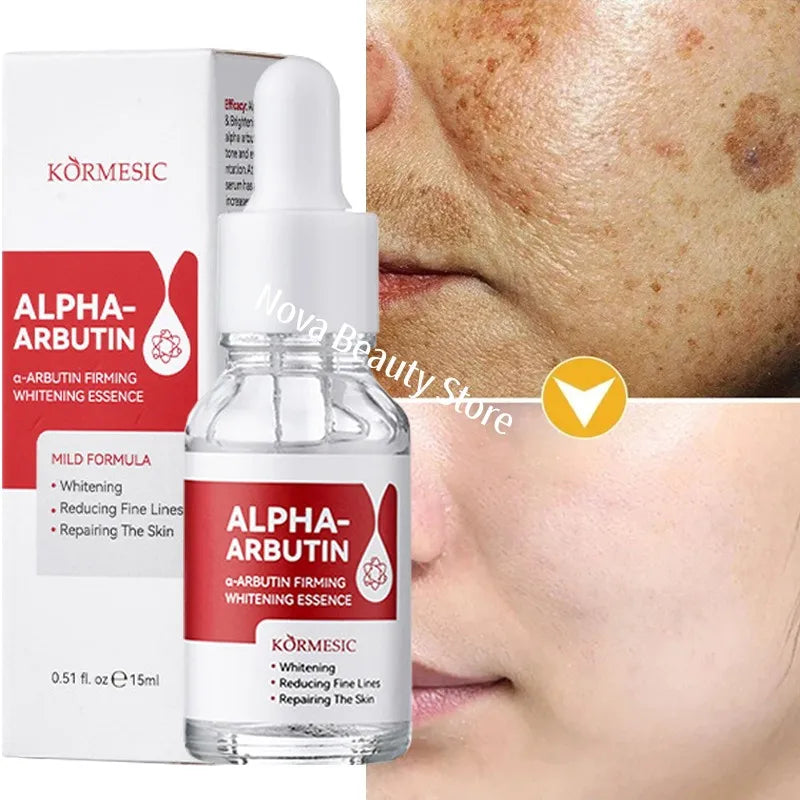 Dark Spot Whitening Repair Serum – Anti-Aging & Pore Minimizer