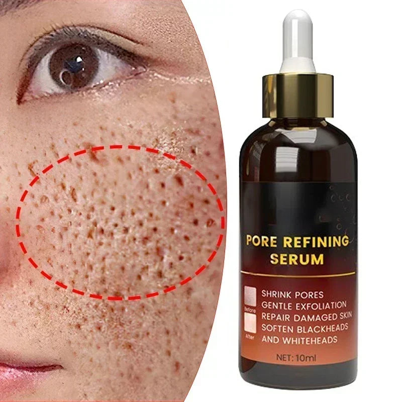 Pore Shrinking Face Cream with Lactobionic Acid – Oil Control & Skin Firming
