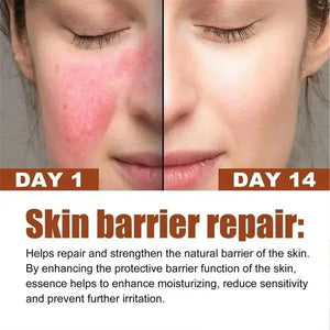 B5 Facial Redness Repair Cream for Sensitive & Acne-Prone Skin – Hydrating & Calming