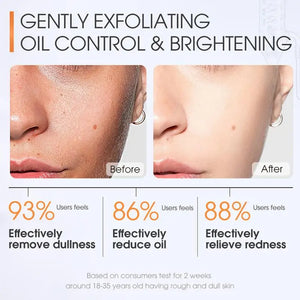 Salicylic Acid Acne Cleanser – Pore Minimizing Scrub 20ml