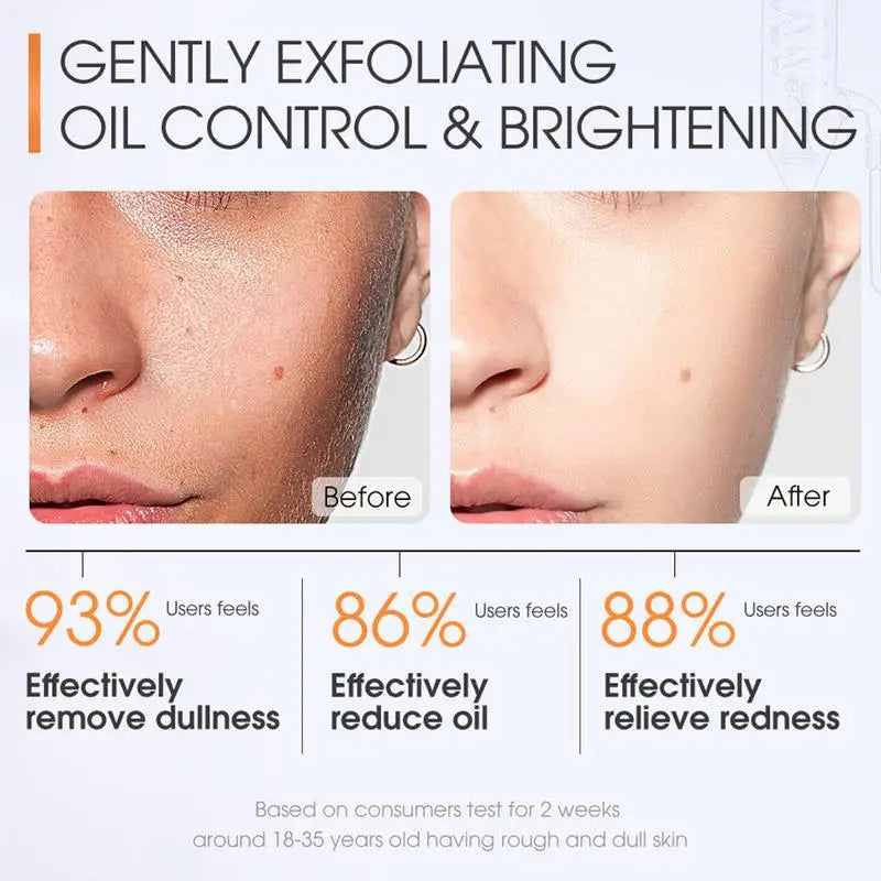 Salicylic Acid Acne Cleanser – Pore Minimizing Scrub 20ml