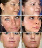 Brightening Freckle Removal Face Serum – Whitening & Hydrating