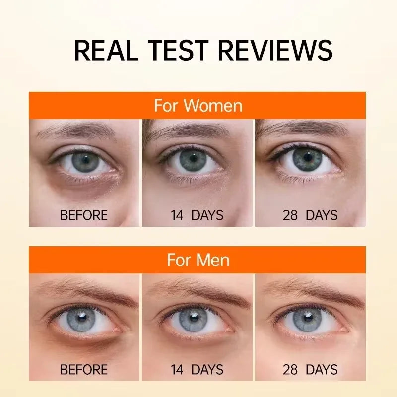 Vitamin C Eye Cream for Dark Circles & Puffiness – 1 Unit