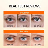 Vitamin C Eye Cream for Dark Circles & Puffiness – 1 Unit