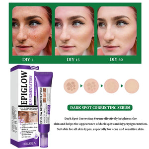 Brightening Freckle Removal Face Serum – Whitening & Hydrating