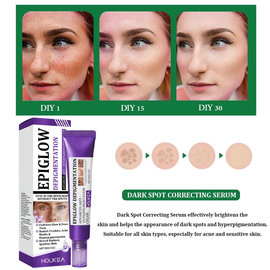 Brightening Freckle Removal Face Serum – Whitening & Hydrating