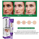 Brightening Freckle Removal Face Serum – Whitening & Hydrating