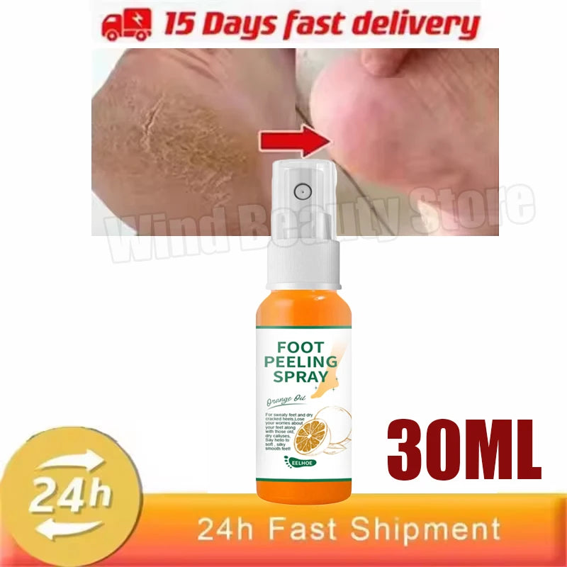 Cracked Heel Repair Foot Cream Spray – Exfoliating & Moisturizing 100ml