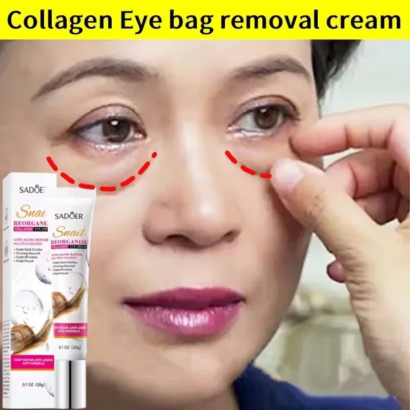 Snail Collagen Eye Cream – Anti-Aging & Moisturizing (20g)