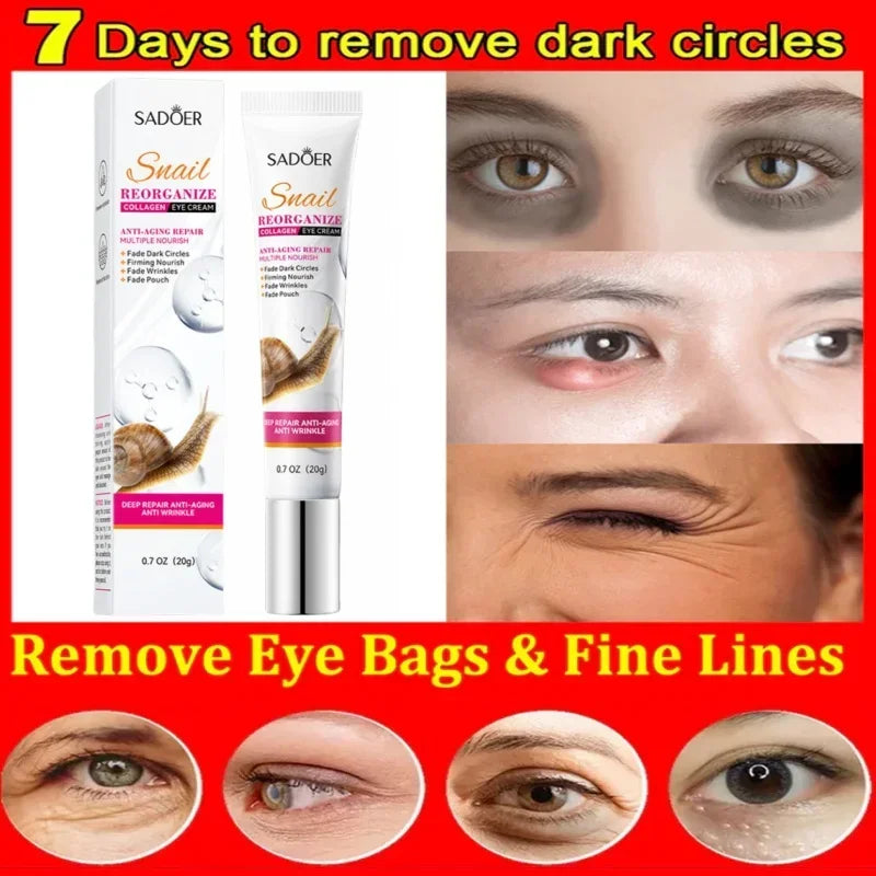 Snail Collagen Eye Cream – Anti-Aging & Moisturizing (20g)