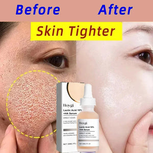Lactic Acid Pore Tightening Serum – Smooth & Hydrate Skin