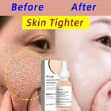 Lactic Acid Pore Tightening Serum – Smooth & Hydrate Skin