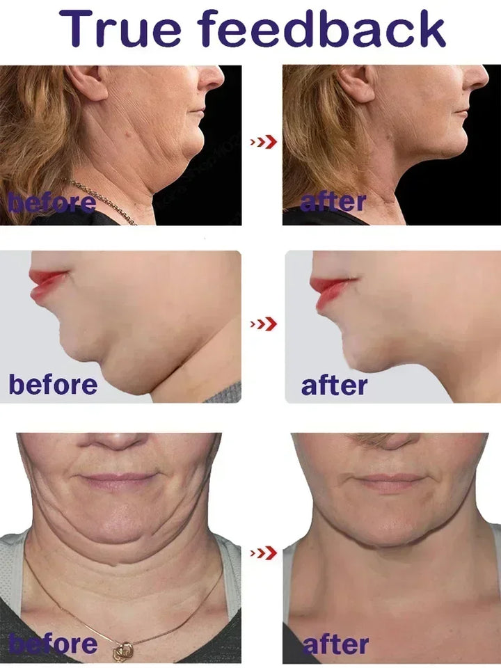 Face Slimming & Double Chin Removal Cream – Deep Moisturizing Treatment
