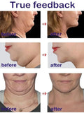 Face Slimming & Double Chin Removal Cream – Deep Moisturizing Treatment
