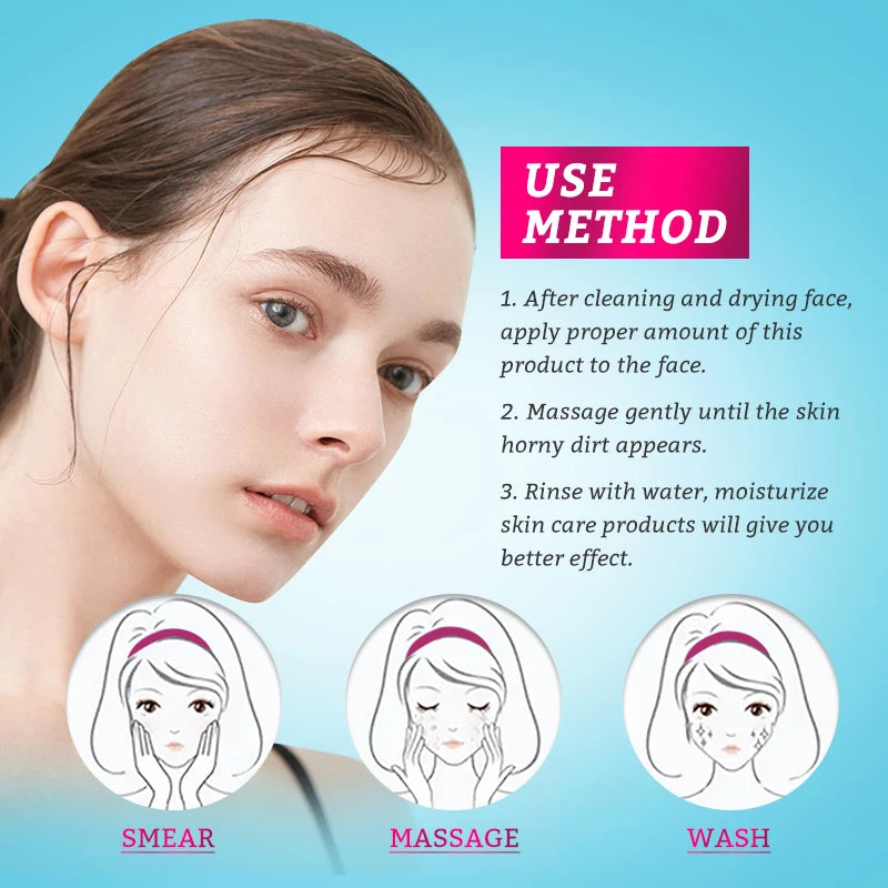 Mango Exfoliating Gel – Gentle Dead Skin Remover & Brightening Scrub (40g)