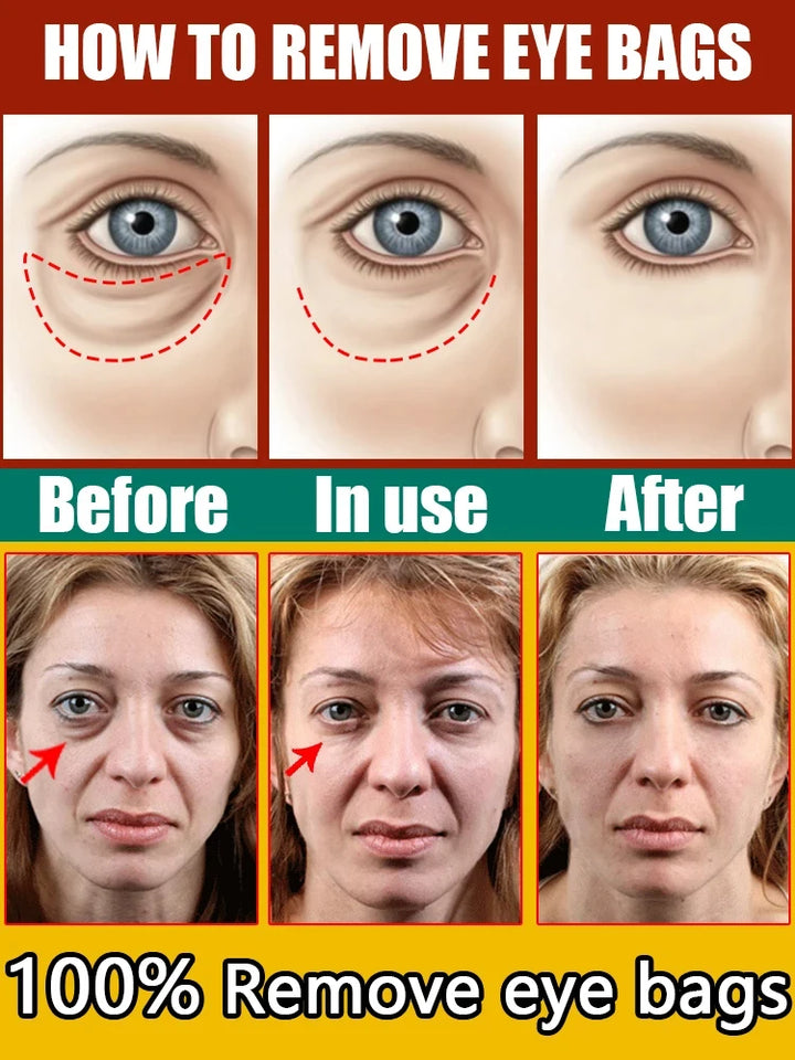 Snail Collagen Eye Cream for Dark Circles & Puffiness
