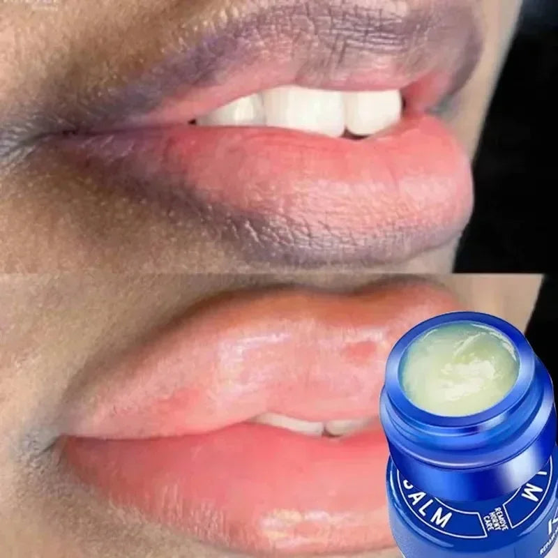 Hydrating Lip Balm – Moisturizing & Nourishing, 7g