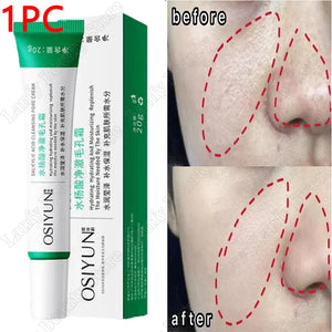 Salicylic Acid Pore Refining Face Cream – 20g