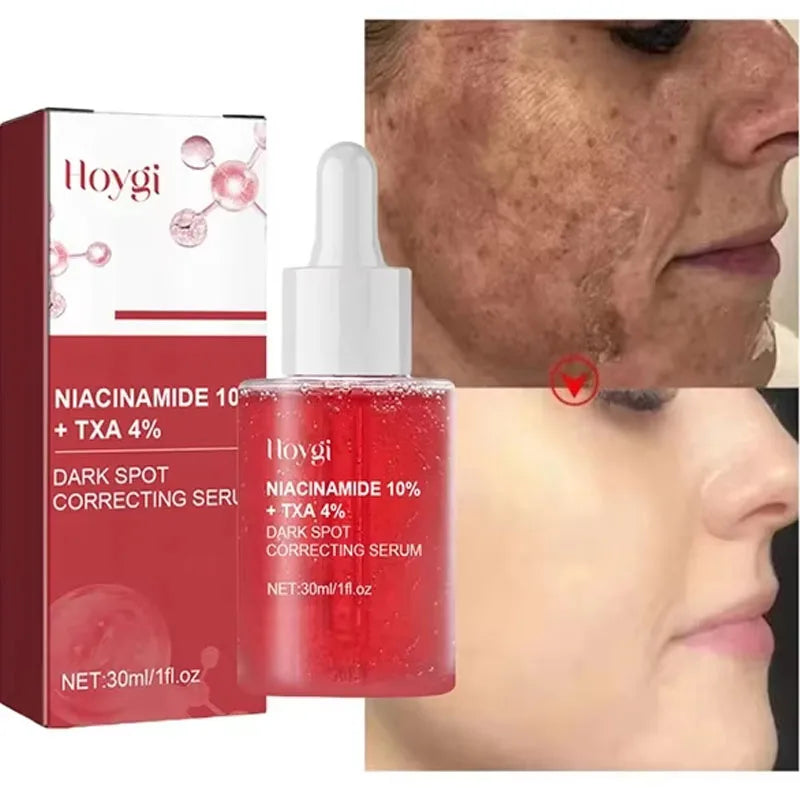 Niacinamide Dark Spot Correcting Serum – 30ml