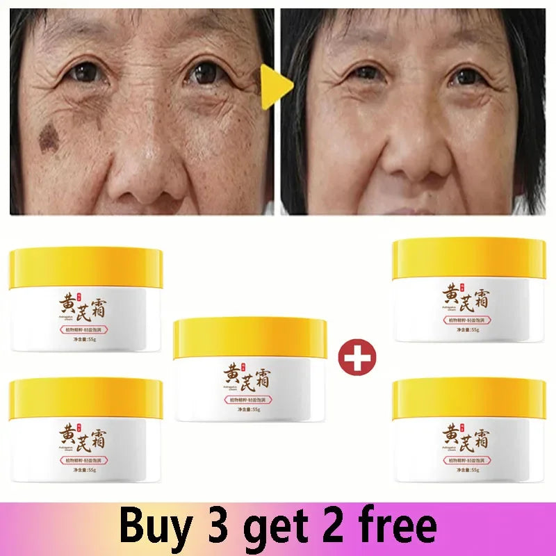 Astragalus Freckle Cream – Dark Spot Remover & Brightening (55g)