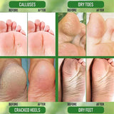Cracked Heel Repair & Foot Moisturizing Cream – 50g